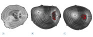 Computertomographie-Bilder geasteter Vogelkirsche, weitere Informationen: Siehe Abbildungsbeschreibung