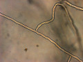 Mikroskopische Aufnahme einer R. solani AG2-2IIIB Pilzhyphe. Die rechtwinkligen Verzweigungen der Pilzhyphen sind charakteristisch für R. solani.
