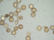 Sporen in einem Mikroskop