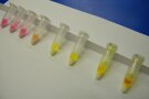 Biochemische Tests zur Identifizierung von Bakterien-Isolaten