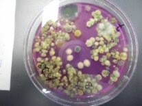 Eine Petrischale mit Pilzkulturen.