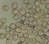 Blick durch ein Mikroskop: Blasen