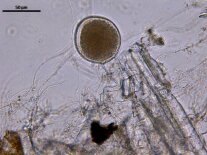 Anaerobe Pilze unter dem Mikroskop im flüssigen Kulturmedium Weizenstroh